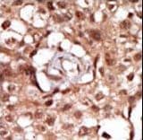 RICK / RIP2 Antibody (aa458-488)