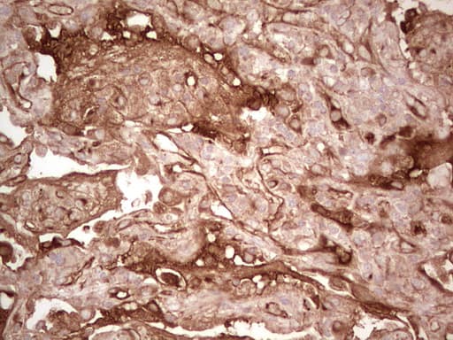 CFI / Complement Factor I Antibody (aa340-583, clone OTI17C5)