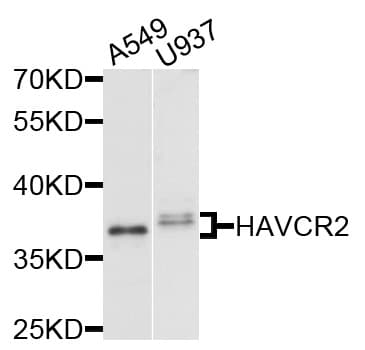 Polyclonal Rabbit anti-Human HAVCR2 / TIM-3 Antibody (aa22-202, IHC, WB)
