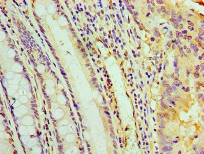 PYCR1 Antibody