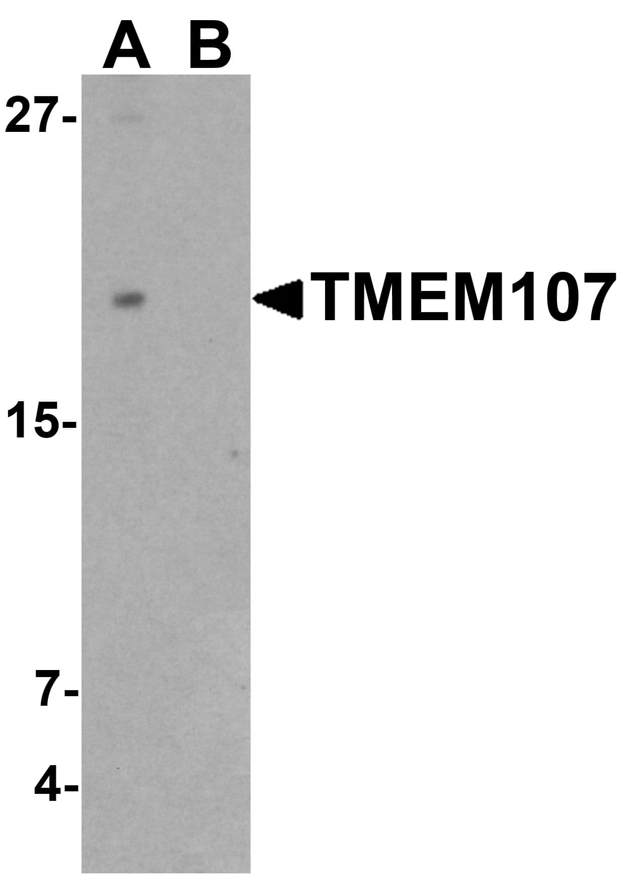 IHC-plus™ TMEM107 Antibody