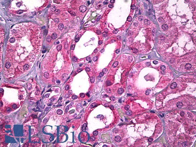IHC-plus™ TP73 / p73 Antibody (aa271-320)
