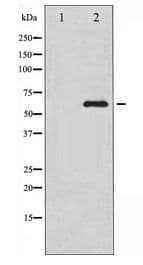 RPS6KB1 / P70S6K / S6K Antibody