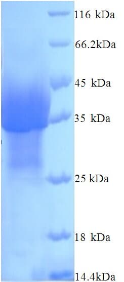 Poliovirus PVRL4 / Nectin 4 Protein (Recombinant His)