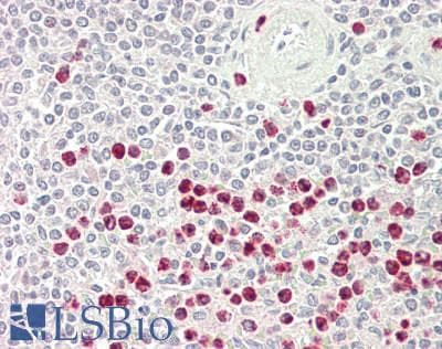 CCL24 / Eotaxin 2 Antibody (HRP)