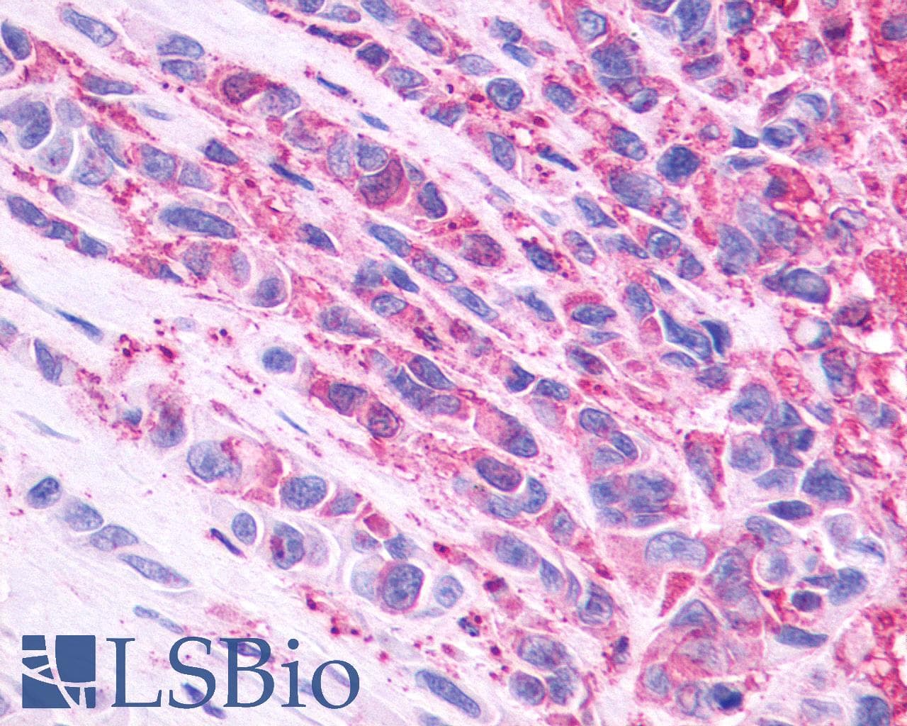 PathPlus™ NMBR Antibody (C-Terminus)