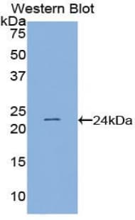 PSIP1 / LEDGF Antibody (aa311-469)