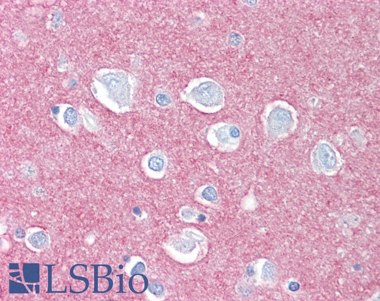 IHC-plus™ CADM2 Antibody (Extracellular Domain)