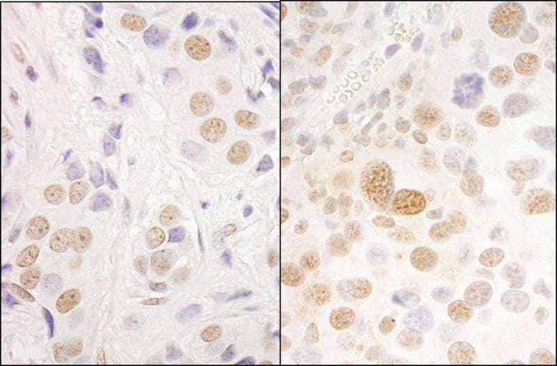 PRPF3 Antibody (aa100-150)