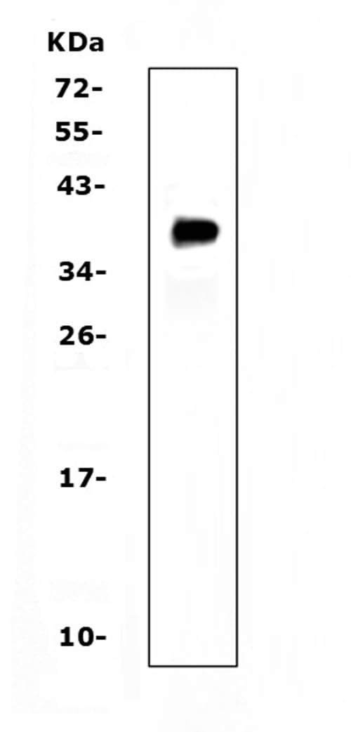 TNFRSF13B / TACI Antibody