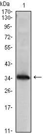 NME1 / NM23 Antibody (clone 4B2)