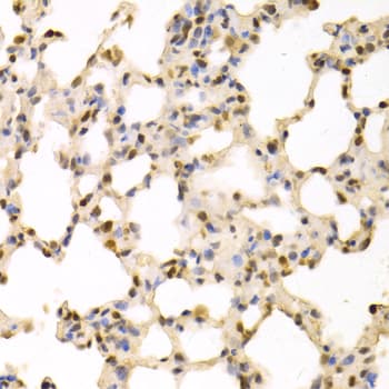 SFN / Stratifin / 14-3-3 Sigma Antibody