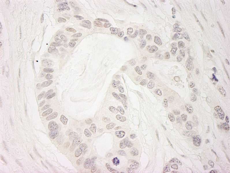 BUB1B / BubR1 Antibody (aa1-50)
