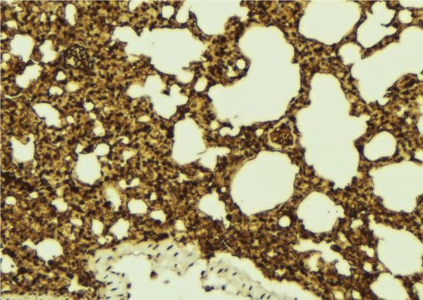 BCAP / PHF11 Antibody