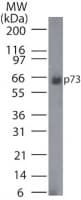 Monoclonal Mouse anti-Human TP73 / p73 Antibody (clone 5B1288, WB)