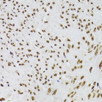 Polyclonal Rabbit anti-Human XRCC6 / Ku70 Antibody (IHC, IF, WB)