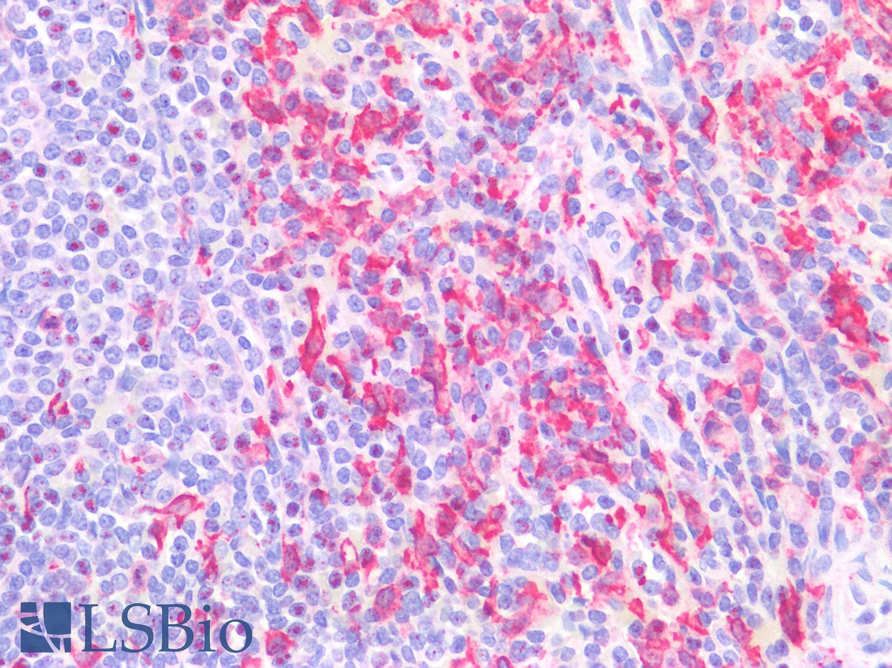 PathPlus™ AIF1 / IBA1 Antibody