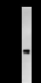 Monoclonal Mouse anti-Human PAX8 Antibody (clone PAX8R1, IF, WB)