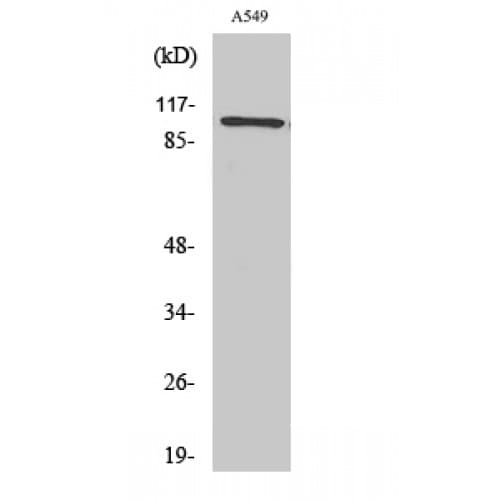 ITGB3 / Integrin Beta 3 / CD61 Antibody (720-800 aa)