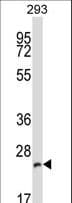 BAP29 / BCAP29 Antibody (aa212-241)