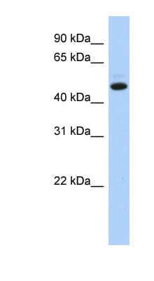 KIAA0825 Antibody (aa71-120)