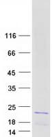 Human HIST2H2BF Protein (Recombinant Myc-DDK (Flag))
