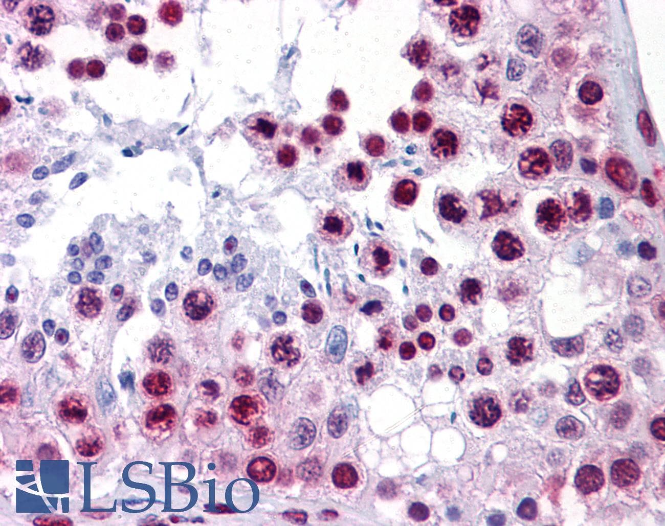 IHC-plus™ HMG1 / HMGB1 Antibody (clone 2F6)
