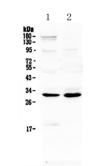 IL-1B / IL-1 Beta Antibody