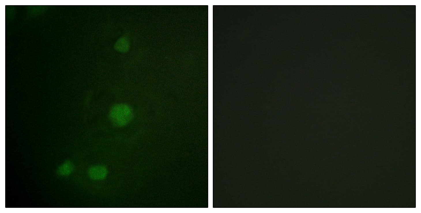 RB1 / Retinoblastoma / RB Antibody (aa771-820)