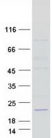 Human TAF13 Protein (Recombinant Myc-DDK (Flag))