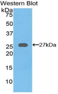 AXIN1 / Axin-1 Antibody (aa654-863)