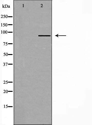 RPTN / Repetin Antibody (aa660-684)