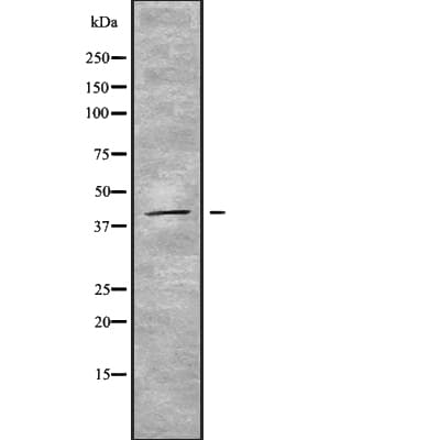 STAC3 Antibody