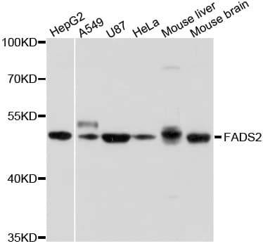 Polyclonal Rabbit anti-Human Delta-6 Desaturase / FADS2 Antibody (WB)