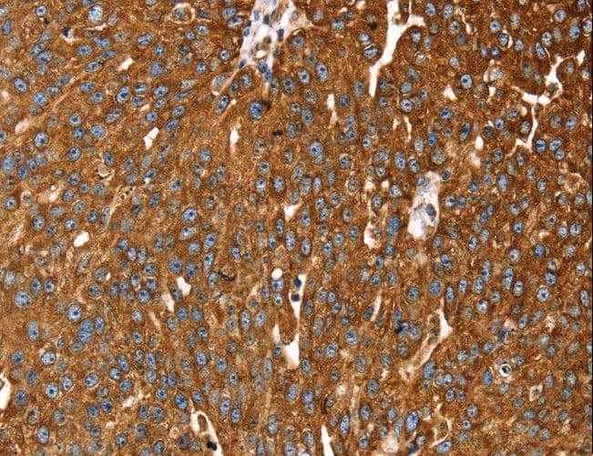 RASSF3 Antibody
