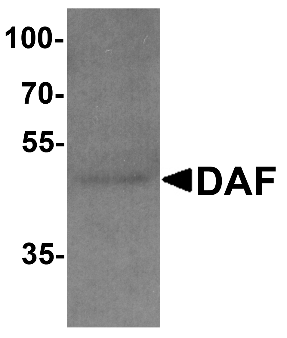 Polyclonal Rabbit anti-Human CD55 Antibody (IHC, IF, WB)