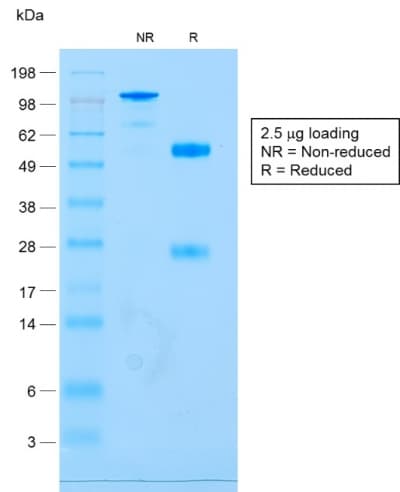 PathPlus™ CD79A / CD79 Alpha Antibody (aa202-216, clone IGA/1688R)