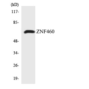 Polyclonal Rabbit anti-Human ZNF460 Antibody (aa447-496, WB)
