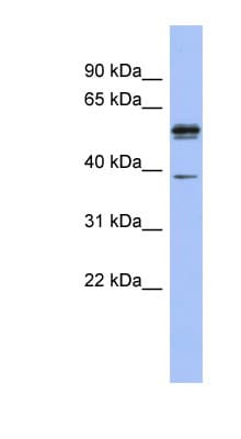 KHDRBS3 / SLM2 Antibody (N-Terminus)