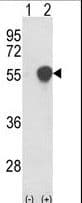 PHGDH Antibody (aa140-168)