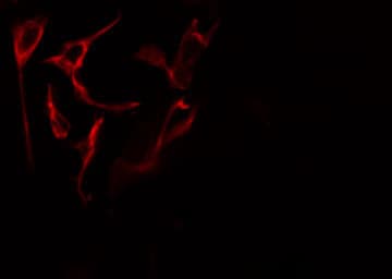 Polyclonal Rabbit anti-Human ZAP70 Antibody (phospho-Tyr319, IHC, IF, WB)
