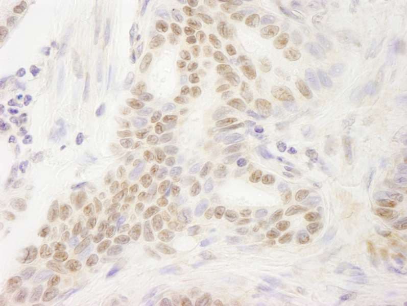 DEK Antibody (aa225-275)