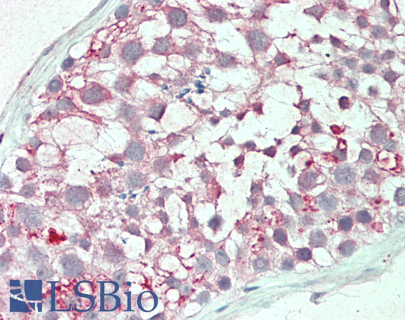IHC-plus™ MRGPRX3 / MRGX3 Antibody (aa89-138)