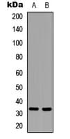 CASP6 / Caspase 6 Antibody (N-Terminus)