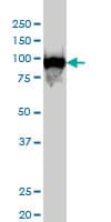 IHC-plus™ Monoclonal Mouse anti-Human CSE1L Antibody (clone 2F4, IHC, IF, WB)