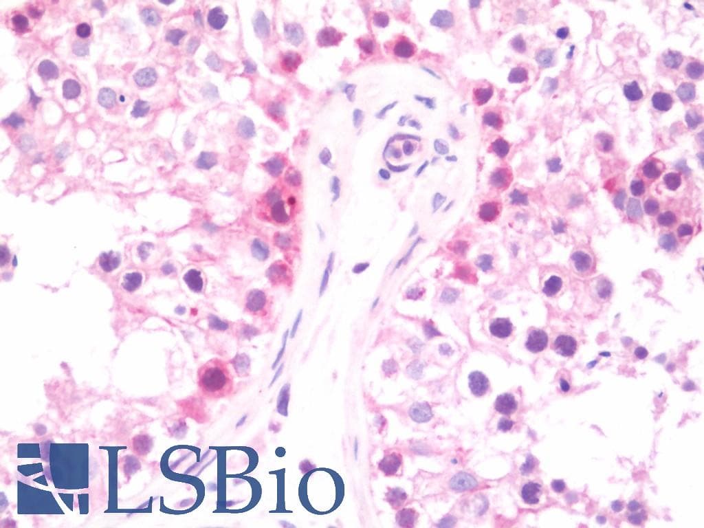 IHC-plus™ DNAJB6 Antibody (aa1-116)