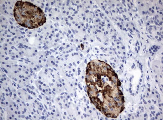 CHGA / Chromogranin A Antibody (clone UMAB109)