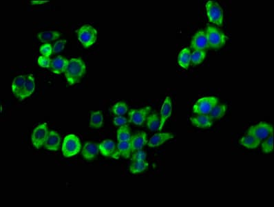 CCKBR / Cckb Antibody