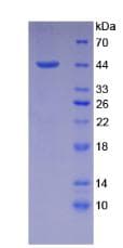 Mouse NPPA / ANP Protein (Recombinant His-GST, N-terminus)