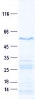 Human ZIK1 Protein (Recombinant His, N-Terminal)